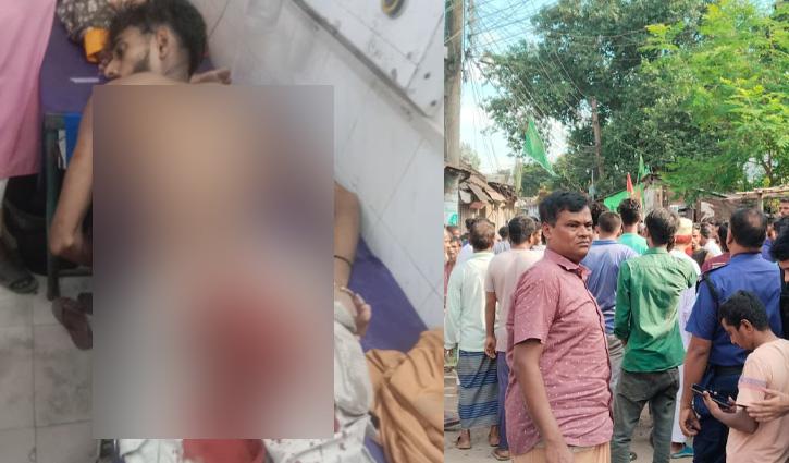 সৈয়দপুরে কিশোর গ্যাং সংঘর্ষে আহত ১০, একজন সংকটাপন্ন - Chief TV
