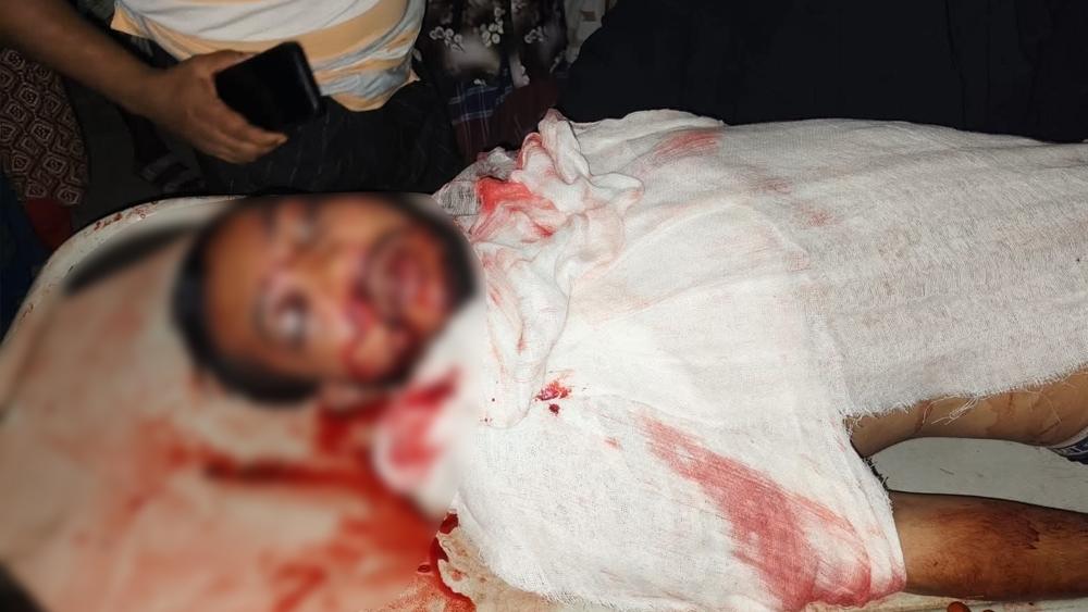 শাহজাদপুরে মোটরসাইকেল মুখোমুখি সংঘর্ষে নিহত ১ - Chief TV
